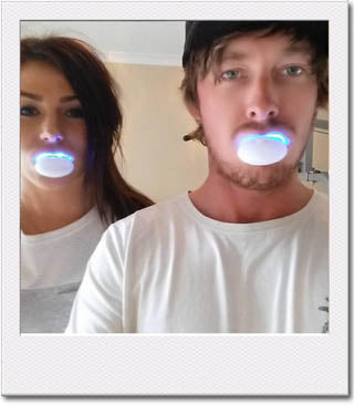 Dentist Dispensed or Over the Counter At Home Whitening Kits